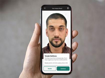 Cureskin to Launch World's First AI-Powered Hair Analyser to Combat Baldness on 20th April 2025 | Cureskin to Launch World's First AI-Powered Hair Analyser to Combat Baldness on 20th April 2025 Cureskin to Launch World's First AI-Powered Hair Analyser to Combat Baldness on 20th April 2025 | Cureskin to Launch World's First AI-Powered Hair Analyser to Combat Baldness on 20th April 2025