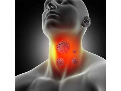 How to Treat Sore Throat? | How to Treat Sore Throat? How to Treat Sore Throat? | How to Treat Sore Throat?