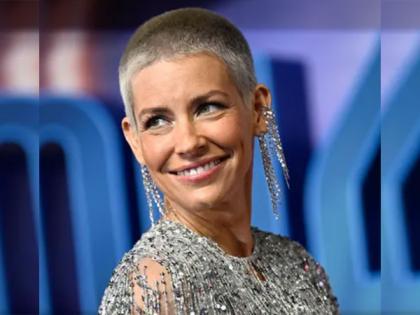 Evangeline Lilly shares pictures of gruesome injuries she sustained after fainting | Evangeline Lilly shares pictures of gruesome injuries she sustained after fainting Evangeline Lilly shares pictures of gruesome injuries she sustained after fainting | Evangeline Lilly shares pictures of gruesome injuries she sustained after fainting