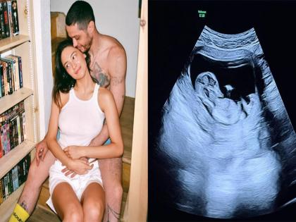 Comedian Pete Davidson, Elsie Hewitt expecting first child together | Comedian Pete Davidson, Elsie Hewitt expecting first child together Comedian Pete Davidson, Elsie Hewitt expecting first child together | Comedian Pete Davidson, Elsie Hewitt expecting first child together