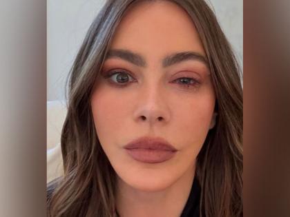 Sofia Vergara misses Emmys due to eye allergy | Sofia Vergara misses Emmys due to eye allergy