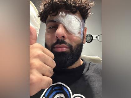 Singer Badshah injures his left eye during final show of the North America music tour | Singer Badshah injures his left eye during final show of the North America music tour