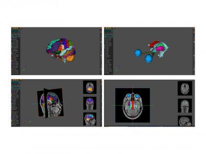 AnaVu: IIIT-Hyderabad's 3D Anatomy Visualization Platform Transforming Medical Education | AnaVu: IIIT-Hyderabad's 3D Anatomy Visualization Platform Transforming Medical Education