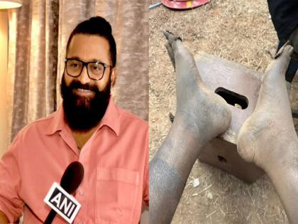 Risabh Shetty shot 'Kantara: Chapter 1' climax with swollen leg, shares unseen pics | Risabh Shetty shot 'Kantara: Chapter 1' climax with swollen leg, shares unseen pics