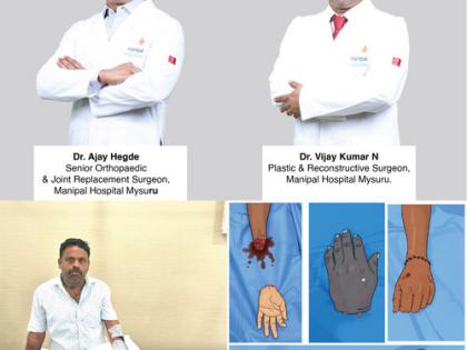 Manipal Hospitals' Mysuru Team Successfully Performs Life-Saving Hand Replantation | Manipal Hospitals' Mysuru Team Successfully Performs Life-Saving Hand Replantation