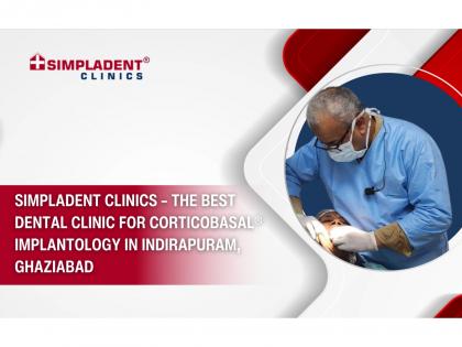 Simpladent Clinics - The Best Dental Clinic for Corticobasal® Implantology in Indirapuram, Ghaziabad | Simpladent Clinics - The Best Dental Clinic for Corticobasal® Implantology in Indirapuram, Ghaziabad Simpladent Clinics - The Best Dental Clinic for Corticobasal® Implantology in Indirapuram, Ghaziabad | Simpladent Clinics - The Best Dental Clinic for Corticobasal® Implantology in Indirapuram, Ghaziabad