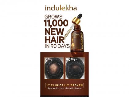 Backed by Science: Indulekha Bringha Hair Growth Serum Completes Second Clinical Trial, Proves New Hair Growth in 90 days | Backed by Science: Indulekha Bringha Hair Growth Serum Completes Second Clinical Trial, Proves New Hair Growth in 90 days Backed by Science: Indulekha Bringha Hair Growth Serum Completes Second Clinical Trial, Proves New Hair Growth in 90 days | Backed by Science: Indulekha Bringha Hair Growth Serum Completes Second Clinical Trial, Proves New Hair Growth in 90 days