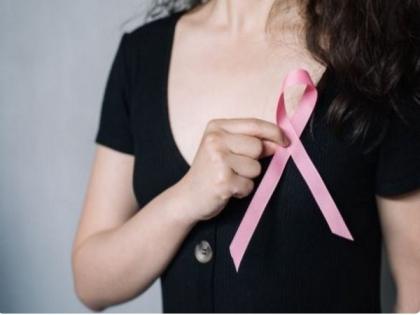 Study defines new factors that can predict recurrence of breast cancer | Study defines new factors that can predict recurrence of breast cancer