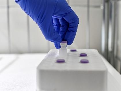 Belgium reports 3,146 new COVID-19 cases | Belgium reports 3,146 new COVID-19 cases Belgium reports 3,146 new COVID-19 cases | Belgium reports 3,146 new COVID-19 cases