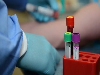 Rapid blood test could detect brain injury in minutes, study shows | Rapid blood test could detect brain injury in minutes, study shows