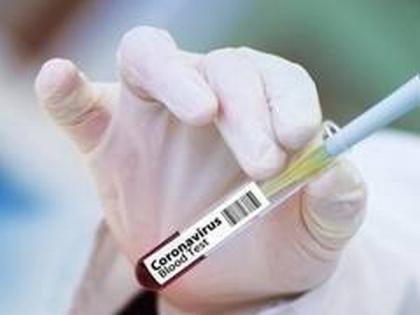 Delhi reports 1,063 new cases of coronavirus | Delhi reports 1,063 new cases of coronavirus Delhi reports 1,063 new cases of coronavirus | Delhi reports 1,063 new cases of coronavirus