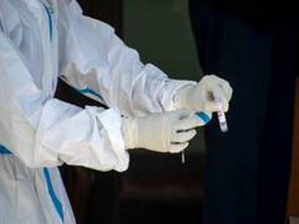 UK records another 24,701 coronavirus cases with 310 deaths | UK records another 24,701 coronavirus cases with 310 deaths UK records another 24,701 coronavirus cases with 310 deaths | UK records another 24,701 coronavirus cases with 310 deaths