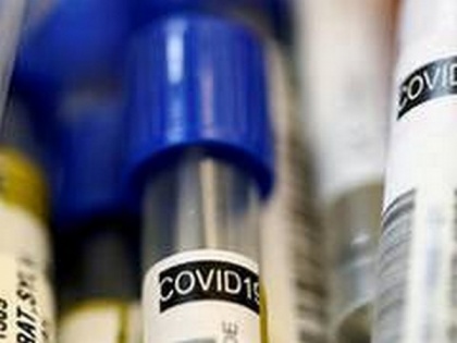 64 new COVID-19 cases in Andhra Pradesh | 64 new COVID-19 cases in Andhra Pradesh