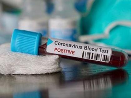 264 COVID-19 cases in Haryana | 264 COVID-19 cases in Haryana 264 COVID-19 cases in Haryana | 264 COVID-19 cases in Haryana