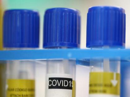 Six new COVID-19 cases in Rajasthan, count reaches 210 | Six new COVID-19 cases in Rajasthan, count reaches 210 Six new COVID-19 cases in Rajasthan, count reaches 210 | Six new COVID-19 cases in Rajasthan, count reaches 210
