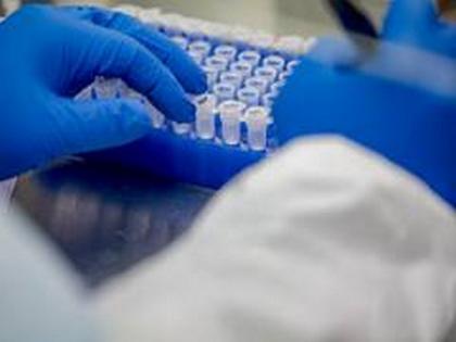 Sree Chitra Tirunal medical institute Kerala develops swabs for COVID-19 testing | Sree Chitra Tirunal medical institute Kerala develops swabs for COVID-19 testing