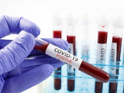 Andhra Pradesh records 753 new COVID-19 cases, 13 deaths | Andhra Pradesh records 753 new COVID-19 cases, 13 deaths Andhra Pradesh records 753 new COVID-19 cases, 13 deaths | Andhra Pradesh records 753 new COVID-19 cases, 13 deaths