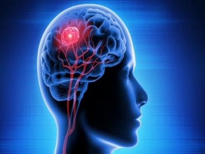 Unpleasant odour is processed more quickly in the brain than perceived quality | Unpleasant odour is processed more quickly in the brain than perceived quality Unpleasant odour is processed more quickly in the brain than perceived quality | Unpleasant odour is processed more quickly in the brain than perceived quality