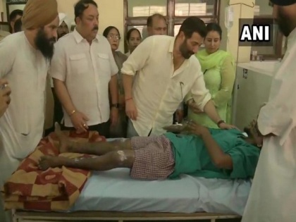 Batala Firecracker Factory Blast: MP Sunny Deol meets injured people at hospital | Batala Firecracker Factory Blast: MP Sunny Deol meets injured people at hospital