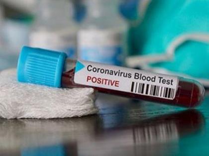 One more tests positive for COVID-19 in Uttarakhand | One more tests positive for COVID-19 in Uttarakhand