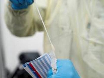 India places orders for 6.3 million RT-PCR kits to test COVID-19 | India places orders for 6.3 million RT-PCR kits to test COVID-19