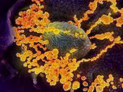 One colleague of coronavirus positive case in Telangana found symptomatic | One colleague of coronavirus positive case in Telangana found symptomatic One colleague of coronavirus positive case in Telangana found symptomatic | One colleague of coronavirus positive case in Telangana found symptomatic