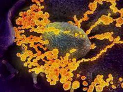 241 isolation wards created in Uttarakhand amid coronavirus outbreak | 241 isolation wards created in Uttarakhand amid coronavirus outbreak 241 isolation wards created in Uttarakhand amid coronavirus outbreak | 241 isolation wards created in Uttarakhand amid coronavirus outbreak