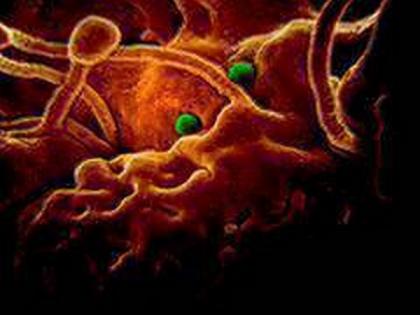 Coronavirus may have started in Xinjiang's prison camps | Coronavirus may have started in Xinjiang's prison camps Coronavirus may have started in Xinjiang's prison camps | Coronavirus may have started in Xinjiang's prison camps