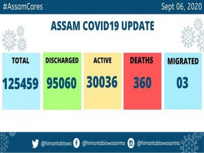 Assam reports 1,537 new COVID-19 cases | Assam reports 1,537 new COVID-19 cases