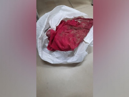 Agencies examining half-burnt cloth, polythene bag recovered from explosion site near Israel Embassy | Agencies examining half-burnt cloth, polythene bag recovered from explosion site near Israel Embassy