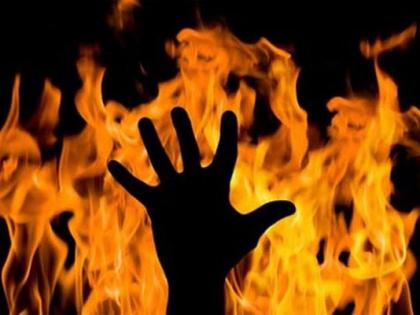 Married woman set afire in Bihar's West Champaran | Married woman set afire in Bihar's West Champaran Married woman set afire in Bihar's West Champaran | Married woman set afire in Bihar's West Champaran