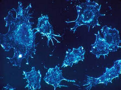 Advance in new therapy with potential benefit for underserved patients with lung, ovarian cancers | Advance in new therapy with potential benefit for underserved patients with lung, ovarian cancers Advance in new therapy with potential benefit for underserved patients with lung, ovarian cancers | Advance in new therapy with potential benefit for underserved patients with lung, ovarian cancers