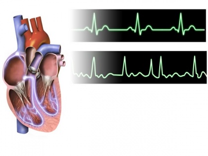 Study defines how to assess quality of care for patients with atrial fibrillation | Study defines how to assess quality of care for patients with atrial fibrillation