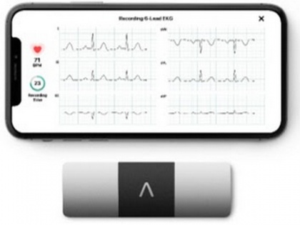 AliveCor brings the world's only six-lead, FDA-cleared personal ECG to India | AliveCor brings the world's only six-lead, FDA-cleared personal ECG to India