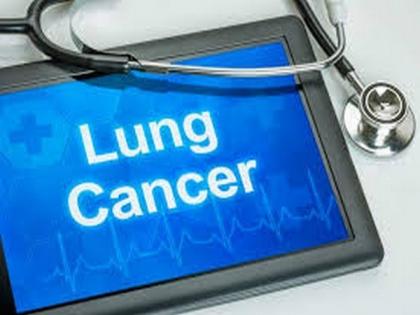 Low-dose CT for lung cancer screening: Benefit outweighs potential harm | Low-dose CT for lung cancer screening: Benefit outweighs potential harm Low-dose CT for lung cancer screening: Benefit outweighs potential harm | Low-dose CT for lung cancer screening: Benefit outweighs potential harm