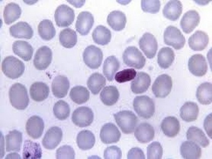 Study reveals malaria discovery could expedite antiviral treatment for COVID-19 | Study reveals malaria discovery could expedite antiviral treatment for COVID-19