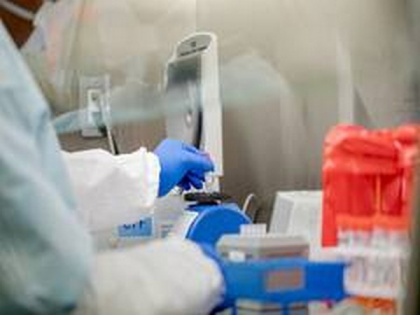UK records another 6,035 coronavirus cases, 144 deaths | UK records another 6,035 coronavirus cases, 144 deaths