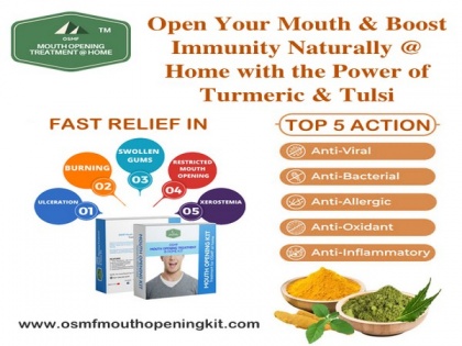 How to boost immunity naturally and open restricted mouth while working from home by Mouth Opening Kit | How to boost immunity naturally and open restricted mouth while working from home by Mouth Opening Kit