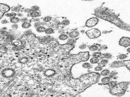 Coronavirus attaches to receptor on respiratory cells, hijack them to produce multiple copies: Study | Coronavirus attaches to receptor on respiratory cells, hijack them to produce multiple copies: Study Coronavirus attaches to receptor on respiratory cells, hijack them to produce multiple copies: Study | Coronavirus attaches to receptor on respiratory cells, hijack them to produce multiple copies: Study