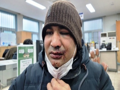 Pakistan's minority rights activist attacked in S Korea seeks help for medical treatment | Pakistan's minority rights activist attacked in S Korea seeks help for medical treatment