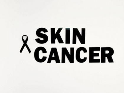 Study finds rare skin cancer patients face 40 per cent recurrence rate | Study finds rare skin cancer patients face 40 per cent recurrence rate
