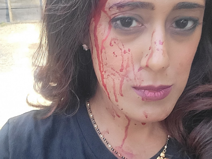 Leader of Indo-Lankan descent attacked in violent carjacking in US | Leader of Indo-Lankan descent attacked in violent carjacking in US