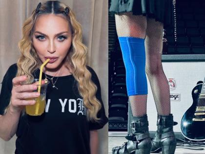 Madonna wears knee brace in pics from rehearsals | Madonna wears knee brace in pics from rehearsals Madonna wears knee brace in pics from rehearsals | Madonna wears knee brace in pics from rehearsals