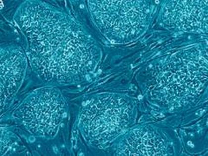 Discovery finds cellular building block acts as a gel, not liquid as previously believed | Discovery finds cellular building block acts as a gel, not liquid as previously believed Discovery finds cellular building block acts as a gel, not liquid as previously believed | Discovery finds cellular building block acts as a gel, not liquid as previously believed