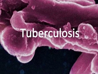 Studies throw light on how TB destroys lungs and how to protect them | Studies throw light on how TB destroys lungs and how to protect them