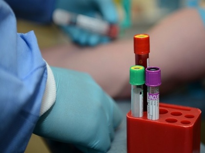 Blood test may help doctors detect pancreatic cancer, says study | Blood test may help doctors detect pancreatic cancer, says study