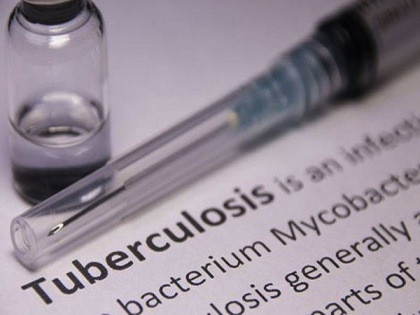 Research: Treatment length for children with tuberculosis now reduced | Research: Treatment length for children with tuberculosis now reduced