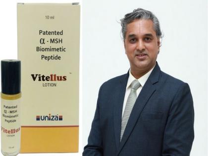 Uniza Group launches a novel solution for the management of Vitiligo | Uniza Group launches a novel solution for the management of Vitiligo