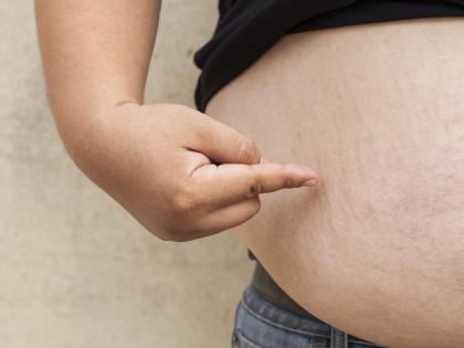 Obesity may up heart disease risk in women than pregnancy complications | Obesity may up heart disease risk in women than pregnancy complications Obesity may up heart disease risk in women than pregnancy complications | Obesity may up heart disease risk in women than pregnancy complications