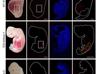 World's first human-like kidneys in grown pigs | World's first human-like kidneys in grown pigs World's first human-like kidneys in grown pigs | World's first human-like kidneys in grown pigs